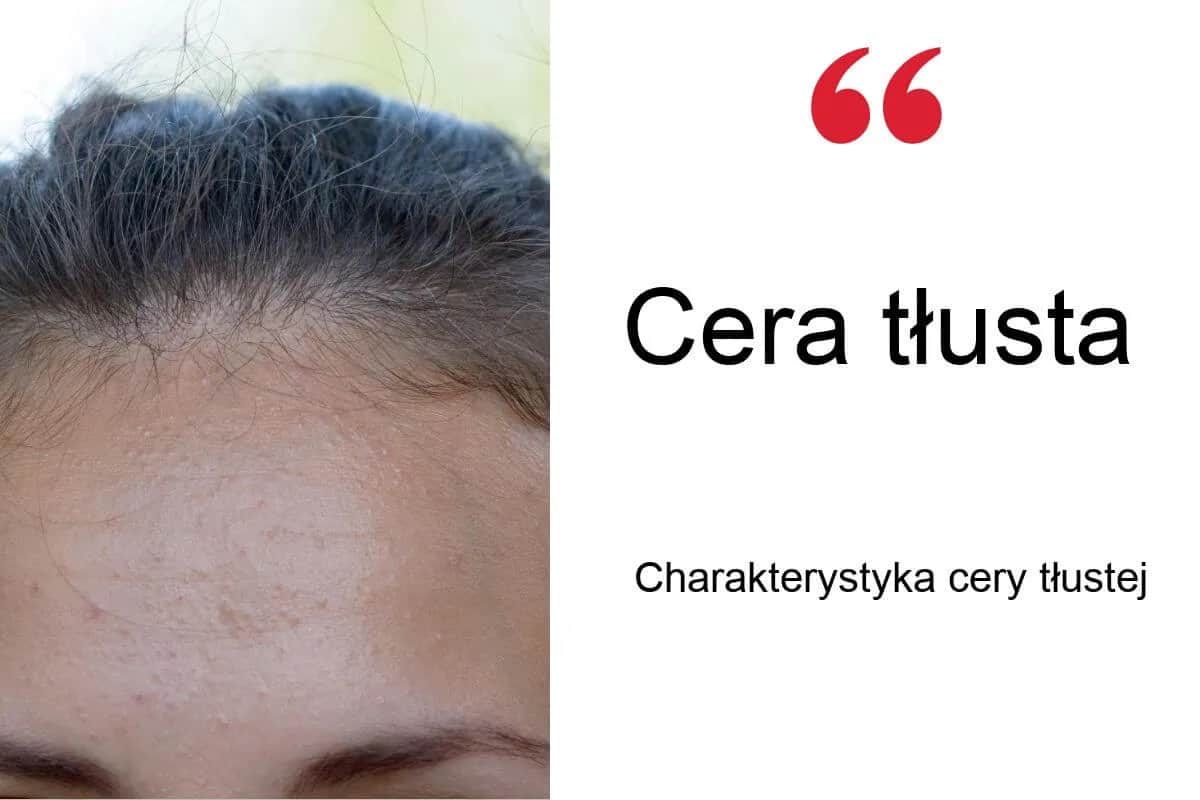 Tłusta cera? Poznaj sprawdzone sposoby na matową skórę bez błyszczenia.